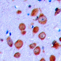 CFTR Antibody