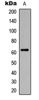 CHK2 (Phospho-S516) Antibody