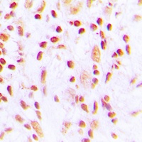 Anti-CHK2 (Phospho-T387) Antibody