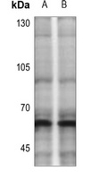 CHK2 (Phospho-T383) Antibody
