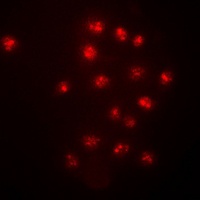 CHK2 (Phospho-T383) Antibody