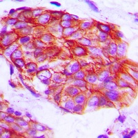 Anti-Claudin 6 Antibody
