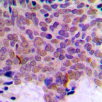 Anti-CLK1 Antibody