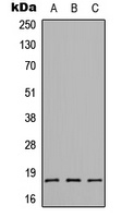 CMTM1 Antibody