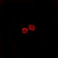 Anti-CMTM1 Antibody