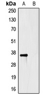 HSV-tag Mouse Monoclonal Antibody