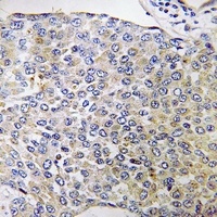 Anti-CPXM2 Antibody
