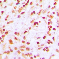 Anti-CBP (Acetyl-K1535) Antibody