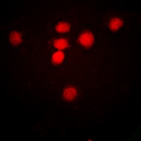 Anti-CBP (Acetyl-K1535) Antibody