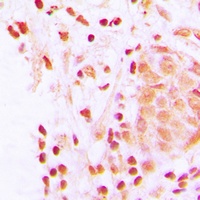 CBP Rabbit Polyclonal Antibody