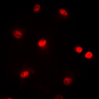CBP Rabbit Polyclonal Antibody