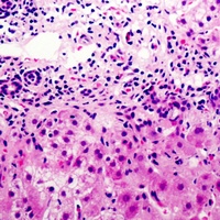 Anti-Cystatin E/M Antibody