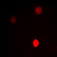 CTBP1 Antibody