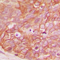 Anti-Beta-catenin (Phospho-S33) Antibody