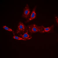 Anti-Beta-catenin (Phospho-S33) Antibody
