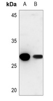 Cathepsin Z Antibody