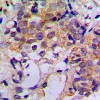 Cathepsin Z Antibody