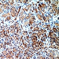CD186 antibody