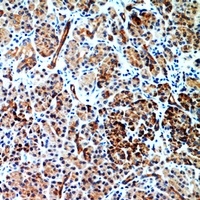 CD186 Antibody