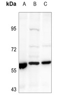 Cytochrome P450 21A2 Rabbit Polyclonal Antibody