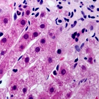 Anti-Cytochrome P450 21A2 Antibody
