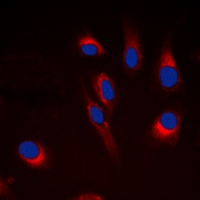 Anti-Cytochrome P450 21A2 Antibody