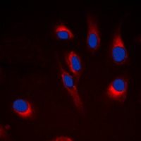 CYP21A2 antibody