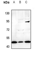 Cytochrome P450 21A2 Rabbit Polyclonal Antibody