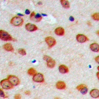 Anti-Cytochrome P450 26C1 Antibody