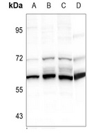 Cytochrome P450 2S1 Rabbit Polyclonal Antibody