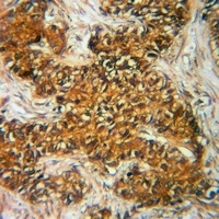 DBI Antibody