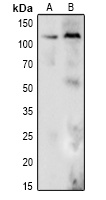 DDX24 Antibody