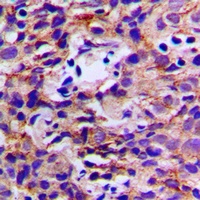 Anti-DDX3Y Antibody