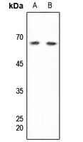 DDX5 Antibody