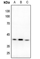 DFF40 Rabbit Polyclonal Antibody