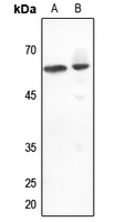 DGK epsilon Rabbit Polyclonal Antibody