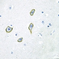 Anti-DGK epsilon Antibody