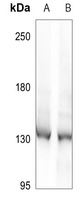 DDX8 Antibody