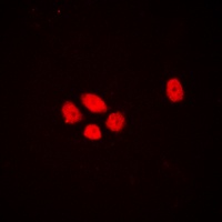 Anti-DLX3 Antibody