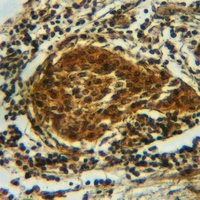 CRMP2 (Phospho-S522) Antibody