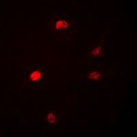 Anti-DUSP22 Antibody