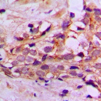 Anti-DYNLL2 Antibody