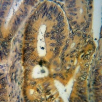 Anti-Endothelin 1 Antibody