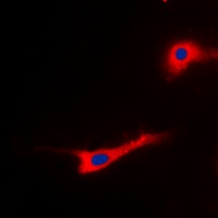 EEF2 (phospho-T56) antibody