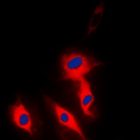 Ephrin A5 antibody