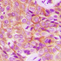 Anti-EGFR (Phospho-T693) Antibody