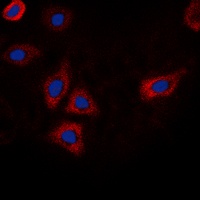 Anti-EGFR (Phospho-T693) Antibody
