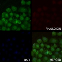 Anti-EIF1 Antibody