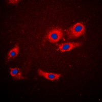 4EBP1 antibody