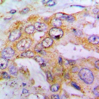 Anti-EIF4G1 (Phospho-S1148) Antibody